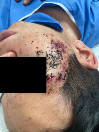 Trabajadores de Limpia Publica del ayuntamiento local golpean    a un hombre por defender a su esposa que era acosada 