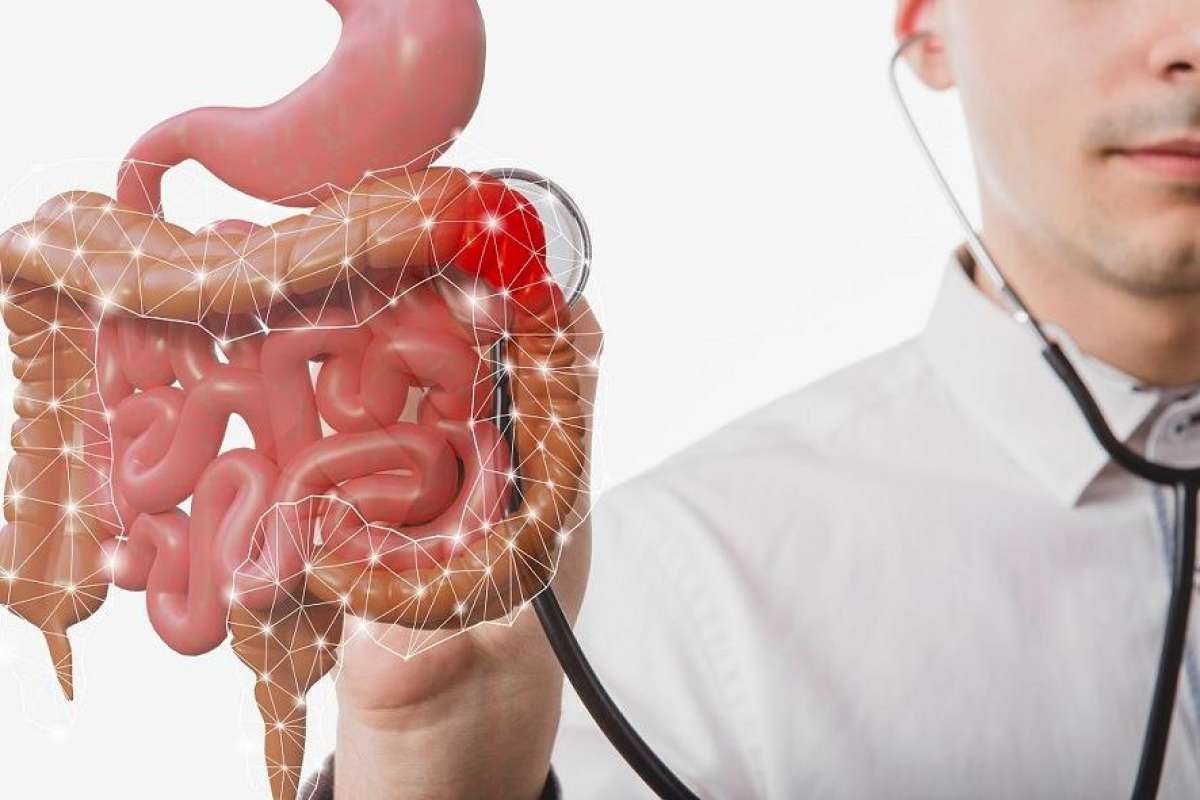 Mantener hábitos saludables y practicar deporte,  son importantes para disminuir cáncer de Colon: IMSS