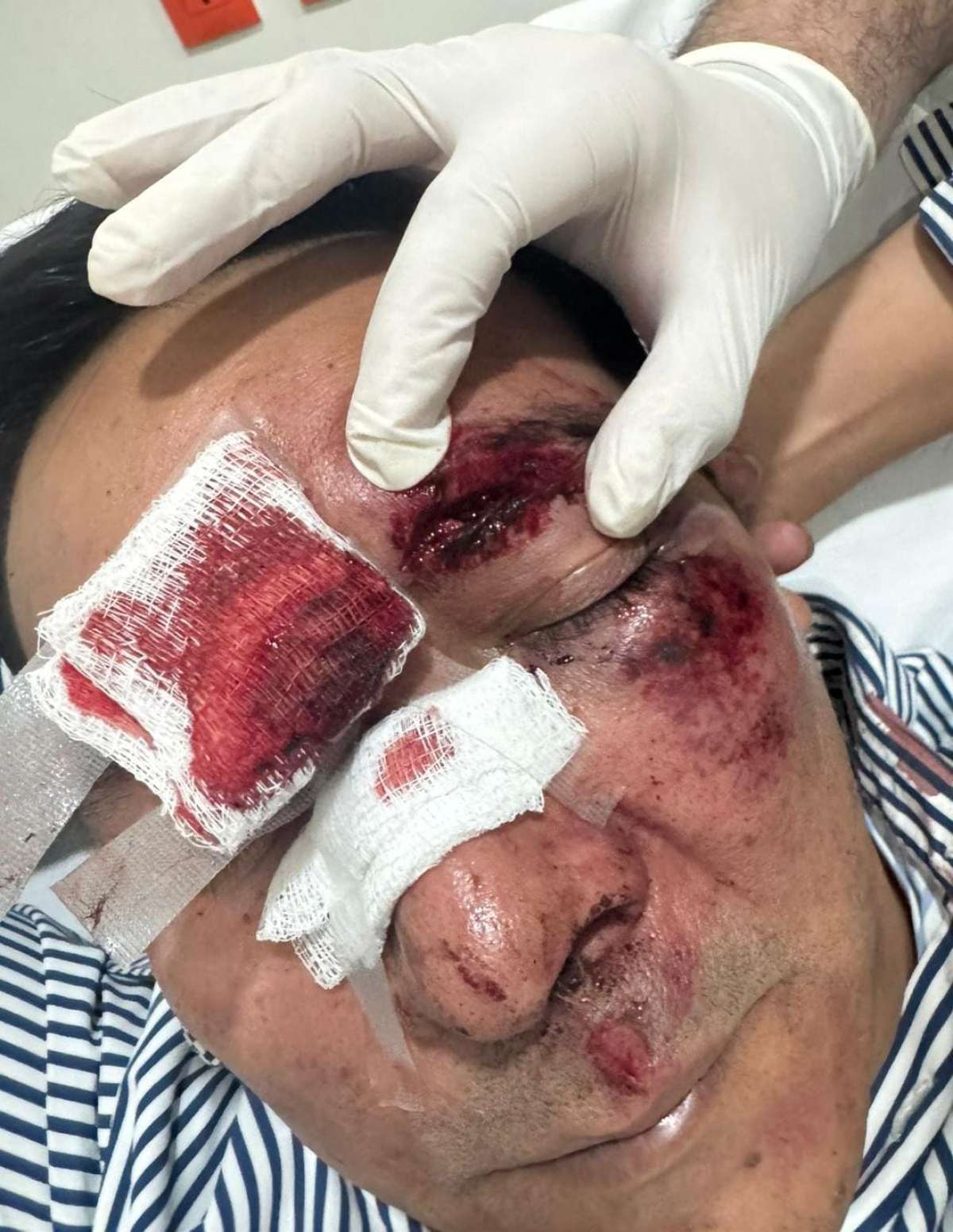 Exdiputado federal Victor Serralde sufre percance en la Ciudad de México, su estado de salud es delicado
