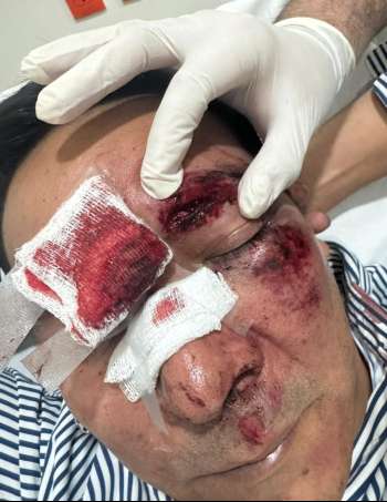 Exdiputado federal Victor Serralde sufre percance en la Ciudad de México, su estado de salud es delicado