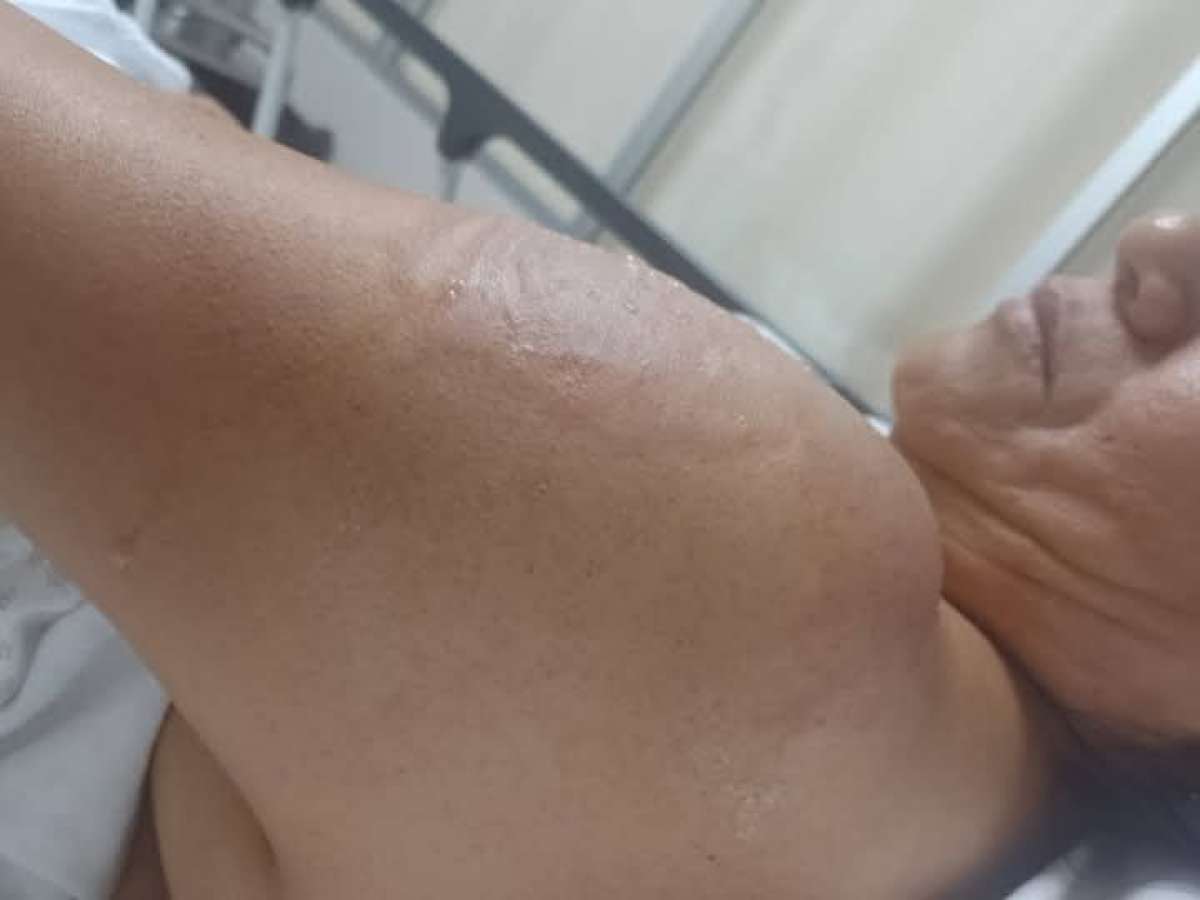Piden justicia familiares de fémina agredida con aceite hirviendo el pasado domingo