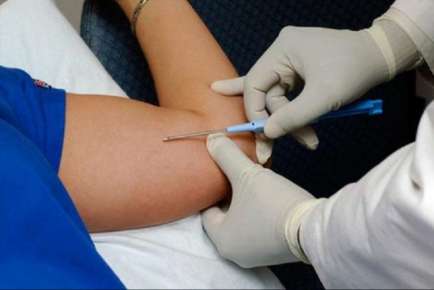 Realizará IMSS Veracruz Sur jornada de colocación de implantes subdérmicos
