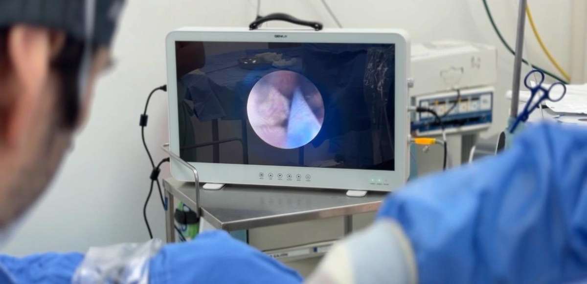 Veracruz, a la vanguardia con procesos quirúrgicos en pacientes renales   